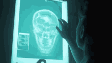 Skull X Ray Kasabian GIF - Skull X Ray Kasabian Youre In Love With A Psycho GIFs