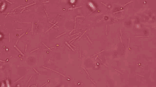 bacteria microorganisms amr antimicrobial resistance superbugs bacteria microorganisms amr antimicrobial resistance superbugs