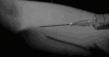 Needle Injection GIF - Needle Injection GIFs