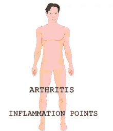 arthritis inflammation joint inflamation