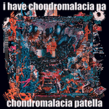 Black Midi Chondro GIF - Black Midi Chondro Chondromalacia GIFs