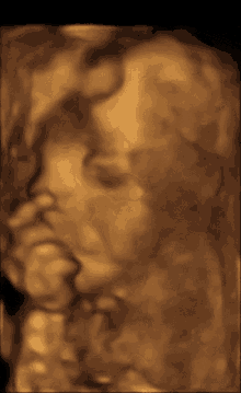 Isaiah Christopher Baby GIF - Isaiah Christopher Baby Ultrasound GIFs