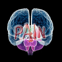 pain painful migraine brain x ray