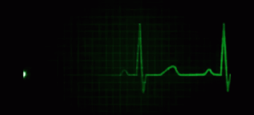 Flatline Heartbeat GIF - Flatline Flat Heartbeat GIFs