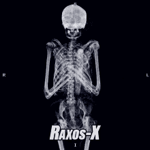 rafiografia rayos x esqueleto huesos