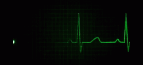 Flat Line Heartbeat GIF - Flat Line Heartbeat Heart GIFs