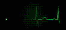 Flat Line Heartbeat GIF - Flat Line Heartbeat Heart GIFs