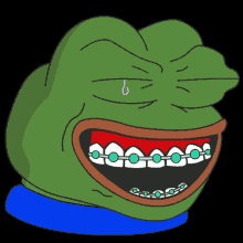 Pepe Laugh Braces GIF - Pepe Laugh Laugh Pepe GIFs