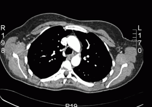 Ct Scan Gif