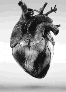 cardiac hear
