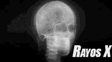 Radiografía De Cráneo GIF - Radiografia Rayos X Huesos De La Cabeza GIFs