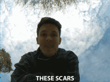 These Scars These Marks GIF - These Scars These Marks The Scars GIFs