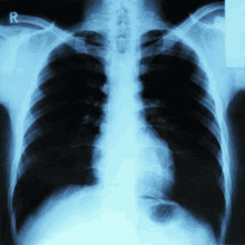 X Ray X Rays GIF - X Ray X Rays Chest X Ray GIFs