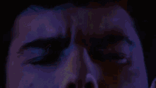 aylmer brain damage brain blue goo aylmer brain damage brain blue goo