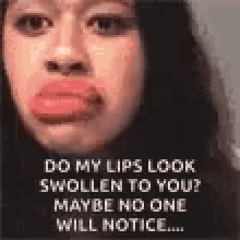 Poisoned Lip GIF - Poisoned Lip Swollen GIFs