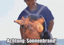 sonnenbrand feuer tom gerhardt ballermann achtung sonnenbrand feuer tom gerhardt ballermann achtung