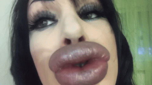 Botox Lips GIFs | Tenor