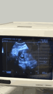 Baby Ultra Sound GIF - Baby Ultra Sound GIFs