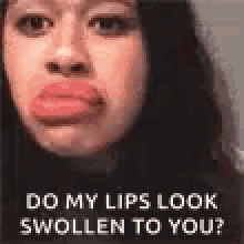 lip swelling