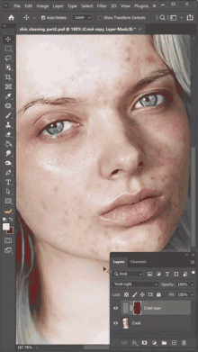 remove pimples rizvanov brush technique editing photoshop