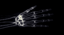 xray hands skeleton