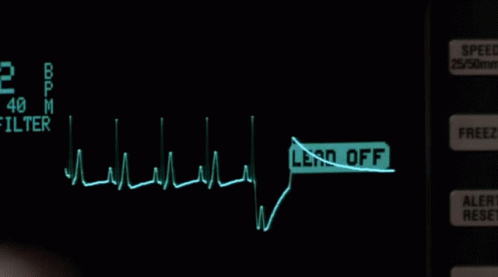 Heartbeat Flatline Gif