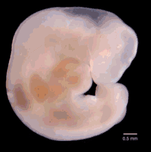 Fetus Baby GIF - Fetus Baby Pregnancy GIFs