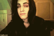 sirius scars scars are badass sirius scars scars are badass