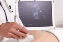 Pregnant Ultrasound GIF - Pregnant Ultrasound Baby GIFs