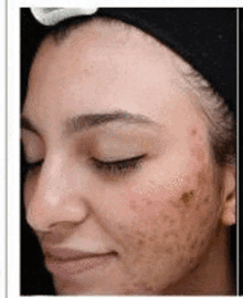 Medical Spa Face GIF - Medical Spa Face Skincare GIFs