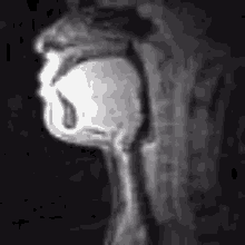 Ct Scan Gif