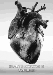 Heart Blockage In Trouble Black Heart GIF - Heart Blockage In Trouble Black Heart Heart GIFs