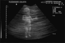 Ultrasound GIF - Ultrasound GIFs