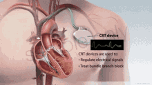 Heart Pump GIF - Heart Pump Anatomy GIFs