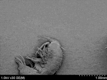 bacteria diatom micro bacteria diatom micro
