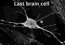 Last Brain Cell Last GIF - Last Brain Cell Last Brain GIFs